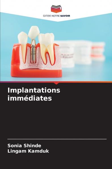 Implantations immédiates