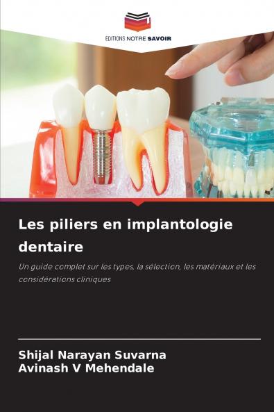 Les piliers en implantologie dentaire