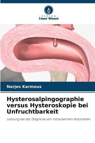 Hysterosalpingographie versus Hysteroskopie bei Unfruchtbarkeit