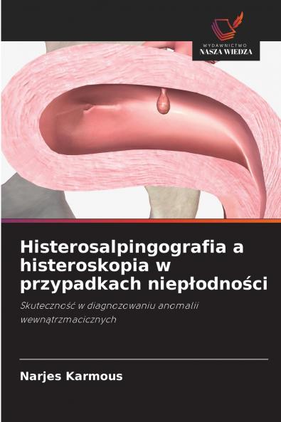 Histerosalpingografia a histeroskopia w przypadkach niep?odno?ci