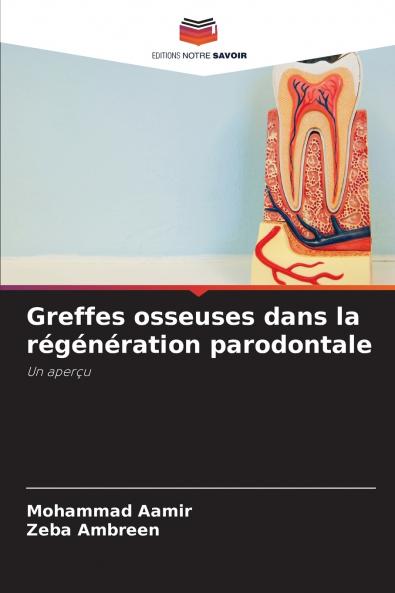 Greffes osseuses dans la régénération parodontale