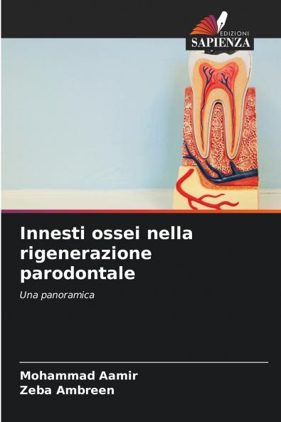 Innesti ossei nella rigenerazione parodontale