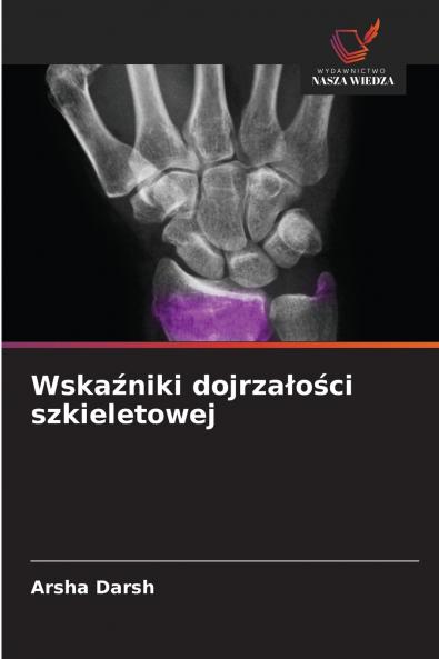 Wskaźniki dojrzałości szkieletowej