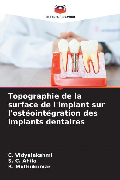 Topographie de la surface de l'implant sur l'ostéointégration des implants dentaires