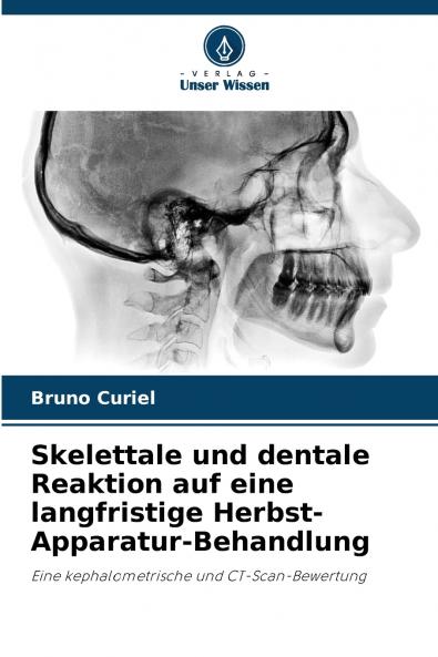 Skelettale und dentale Reaktion auf eine langfristige Herbst-Apparatur-Behandlung