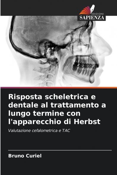 Risposta scheletrica e dentale al trattamento a lungo termine con l'apparecchio di Herbst