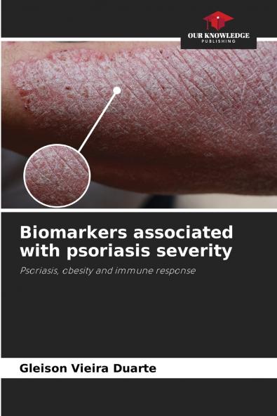 Biomarkers associated with psoriasis severity