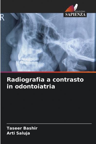 Radiografia a contrasto in odontoiatria