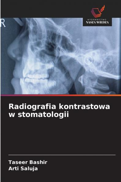 Radiografia kontrastowa w stomatologii