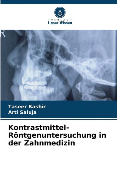 Kontrastmittel-Röntgenuntersuchung in der Zahnmedizin