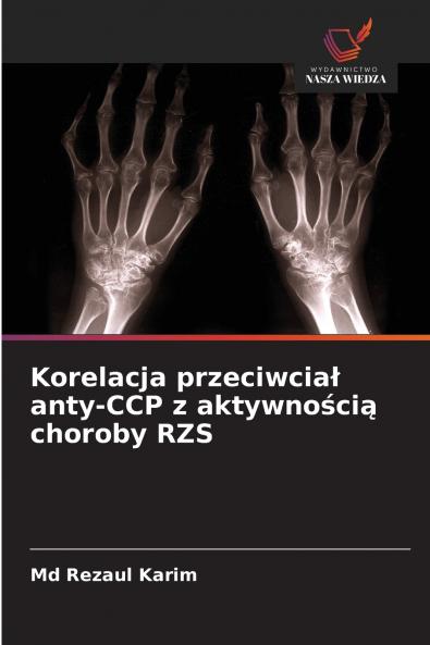 Korelacja przeciwciał anty-CCP z aktywnością choroby RZS