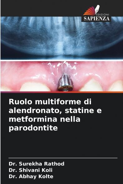Ruolo multiforme di alendronato statine e metformina nella parodontite