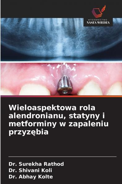 Wieloaspektowa rola alendronianu statyny i metforminy w zapaleniu przyzębia