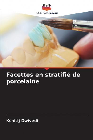 Facettes en stratifié de porcelaine