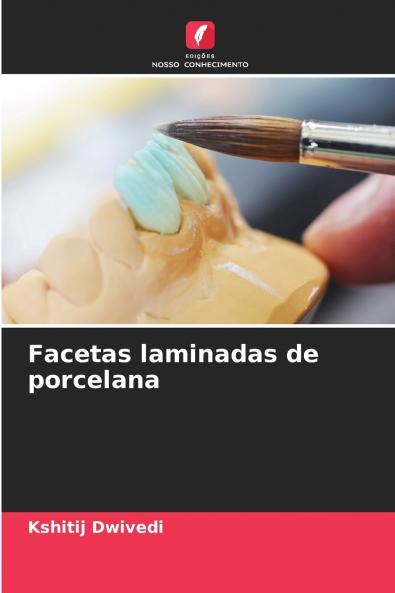 Facetas laminadas de porcelana