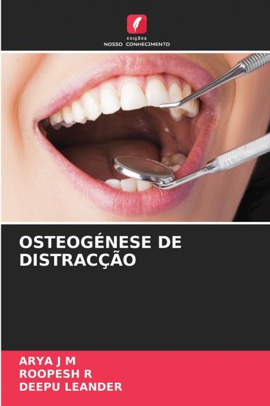 OSTEOGÉNESE DE DISTRACÇÃO
