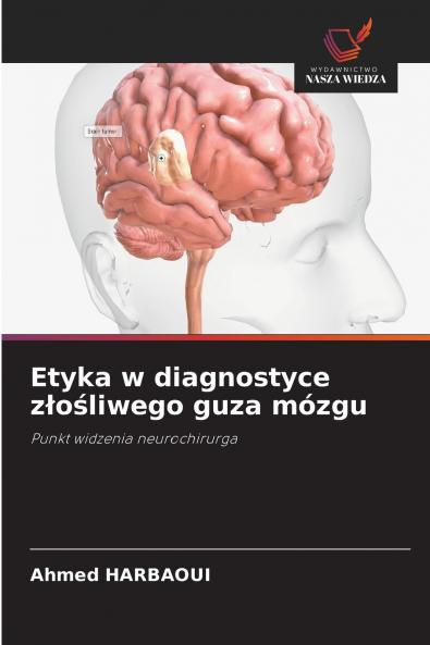 Etyka w diagnostyce złośliwego guza mózgu