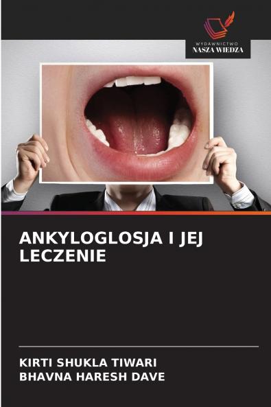 ANKYLOGLOSJA I JEJ LECZENIE