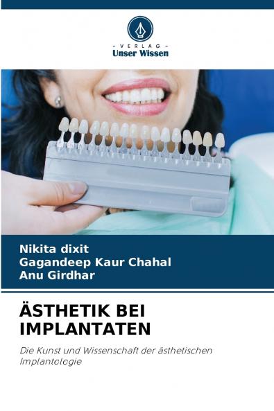 ÄSTHETIK BEI IMPLANTATEN