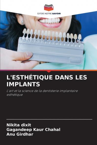 L'ESTHÉTIQUE DANS LES IMPLANTS