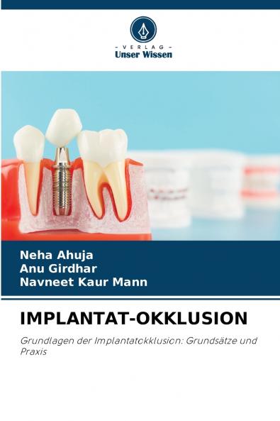 IMPLANTAT-OKKLUSION