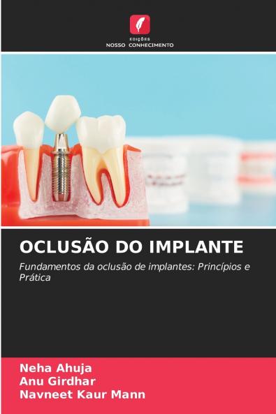 OCLUSÃO DO IMPLANTE