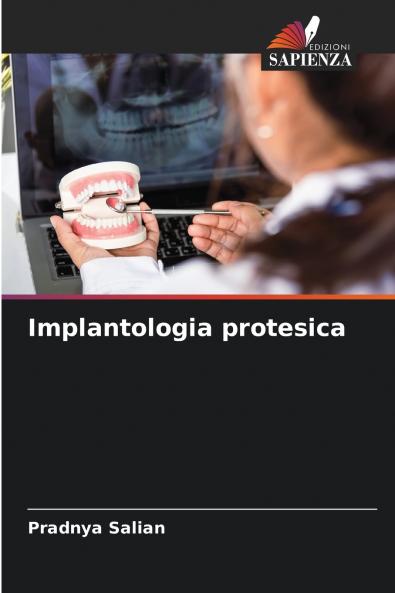 Implantologia protesica