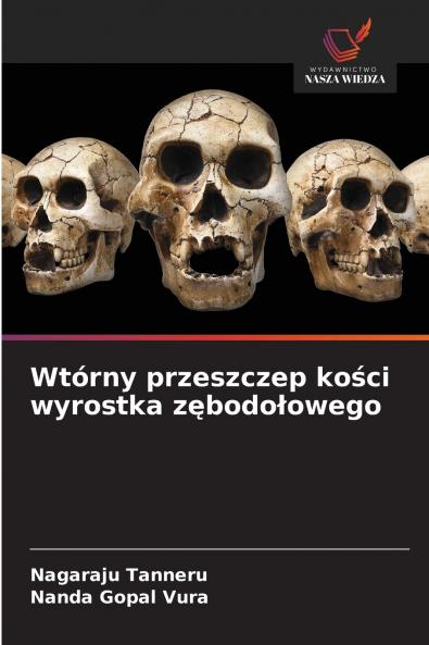 Wtórny przeszczep kości wyrostka zębodołowego
