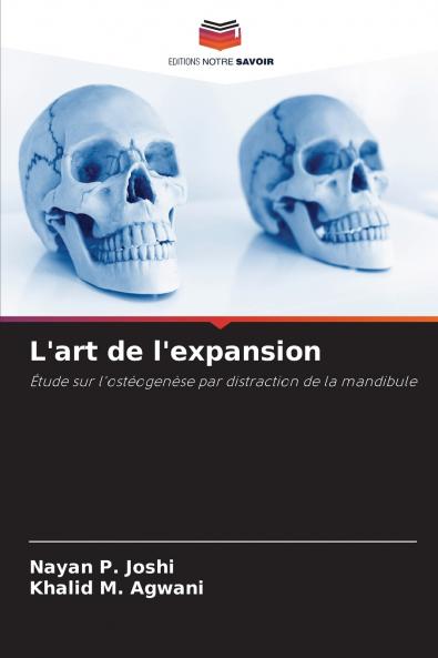 L'art de l'expansion