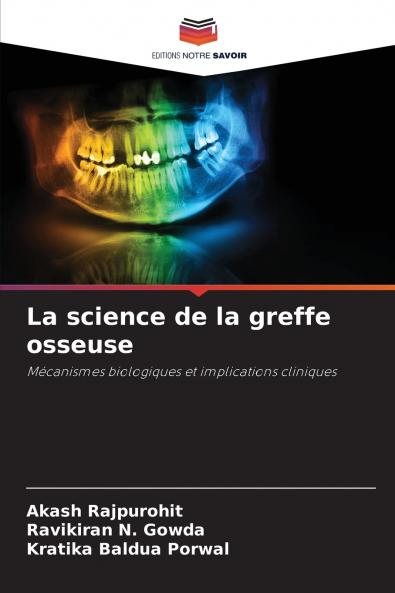 La science de la greffe osseuse