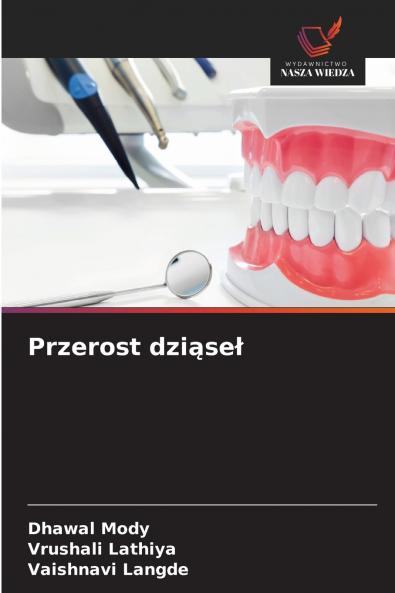 Przerost dziąseł
