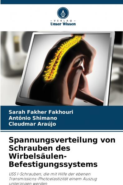 Spannungsverteilung von Schrauben des Wirbelsäulen-Befestigungssystems