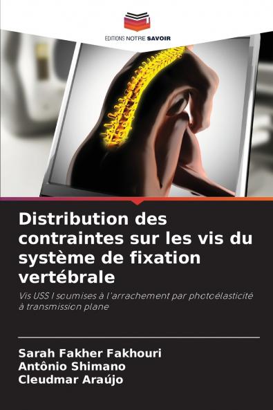 Distribution des contraintes sur les vis du système de fixation vertébrale