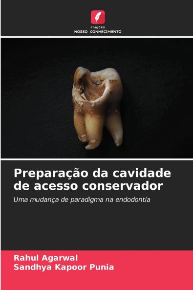 Preparação da cavidade de acesso conservador