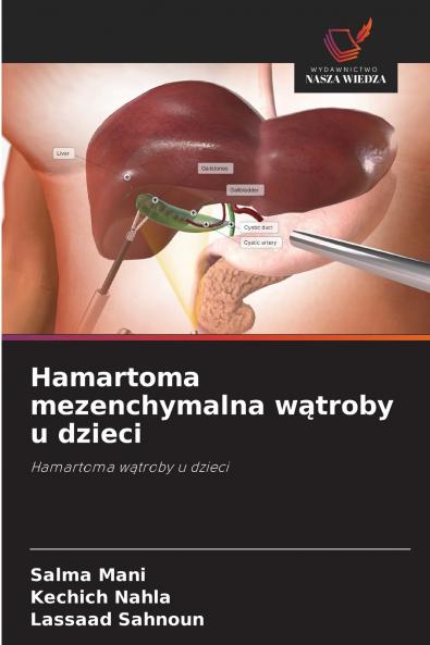 Hamartoma mezenchymalna wątroby u dzieci