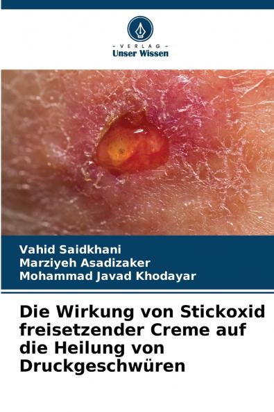 Die Wirkung von Stickoxid freisetzender Creme auf die Heilung von Druckgeschwüren