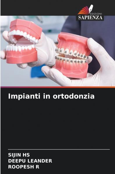 Impianti in ortodonzia