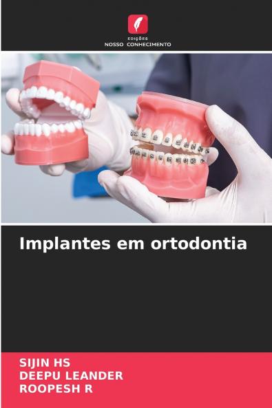 Implantes em ortodontia