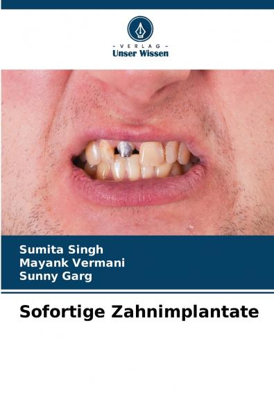 Sofortige Zahnimplantate