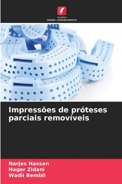 Impressões de próteses parciais removíveis