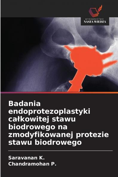 Badania endoprotezoplastyki całkowitej stawu biodrowego na zmodyfikowanej protezie stawu biodrowego