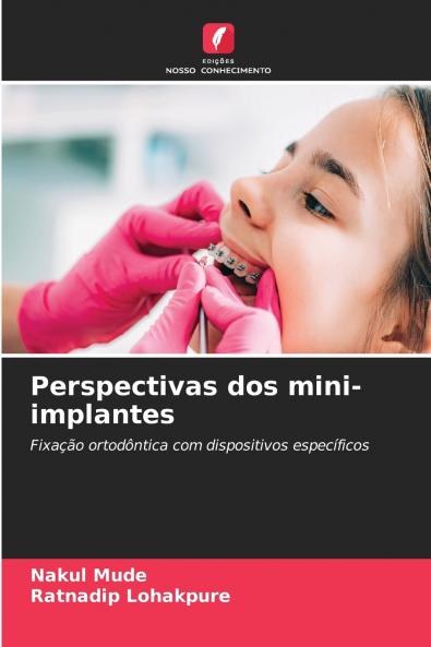 Perspectivas dos mini-implantes