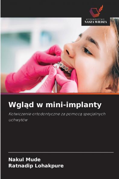 Wgląd w mini-implanty