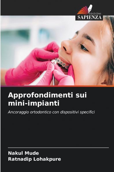Approfondimenti sui mini-impianti