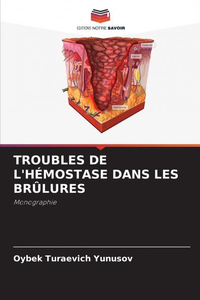 TROUBLES DE L'HÉMOSTASE DANS LES BRÛLURES