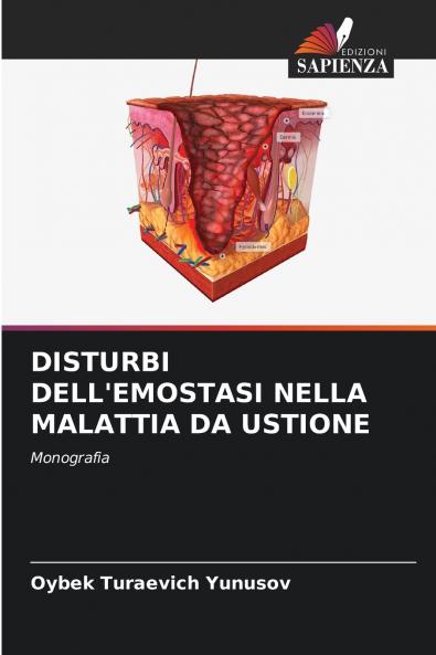 DISTURBI DELL'EMOSTASI NELLA MALATTIA DA USTIONE