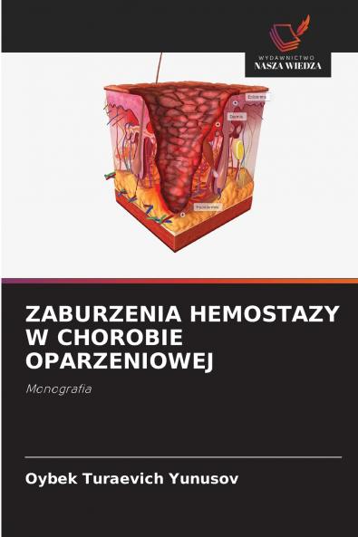 ZABURZENIA HEMOSTAZY W CHOROBIE OPARZENIOWEJ