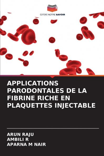 APPLICATIONS PARODONTALES DE LA FIBRINE RICHE EN PLAQUETTES INJECTABLE