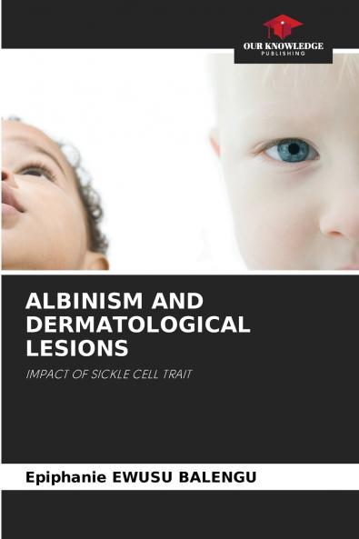 ALBINISM AND DERMATOLOGICAL LESIONS