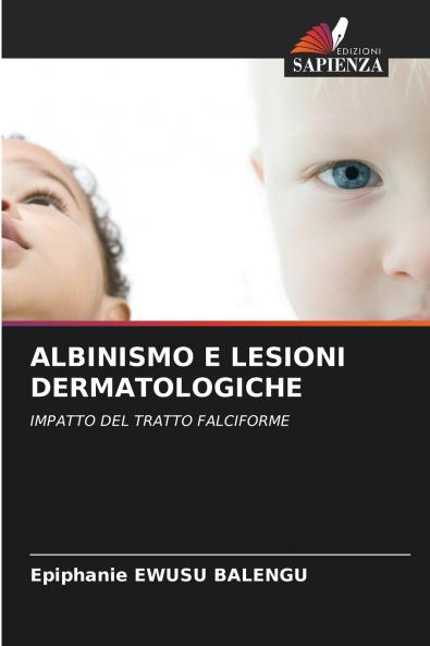 ALBINISMO E LESIONI DERMATOLOGICHE